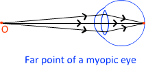 far point of myopic eye